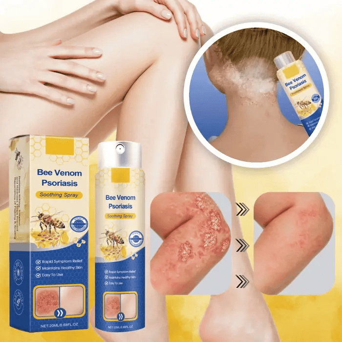PsoriaLind™