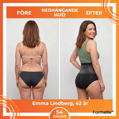 Formelle™ Shaping-shorts | Formande shorts för en slät siluett under kläderna