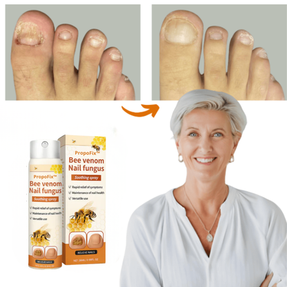 Propofix™ | Hjälper till att minska nagelsvamp och förbättra naglarnas utseende på upp till 7 dagar.