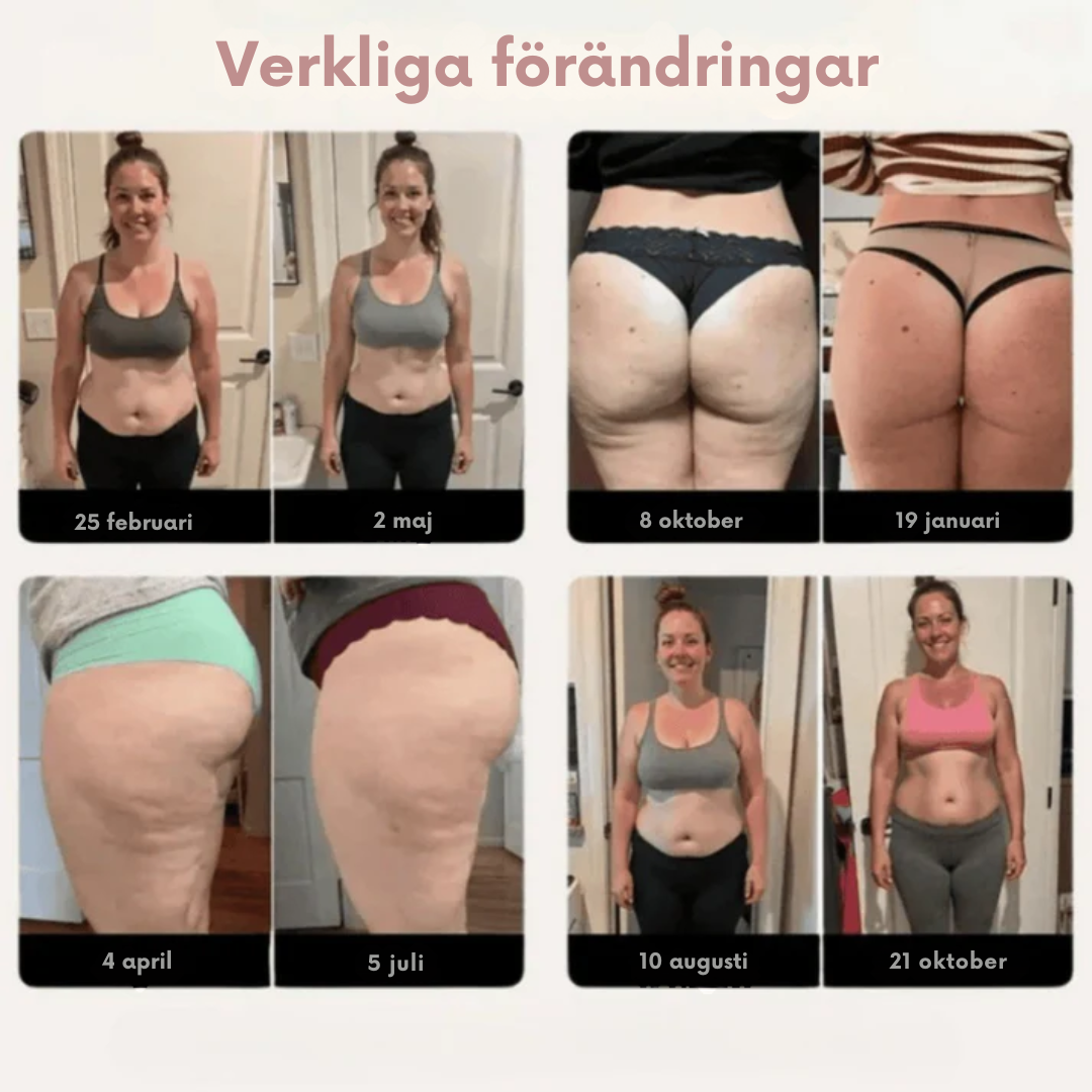 CirkuForm™ Leggings | Leggings som aktivt motverkar celluliter