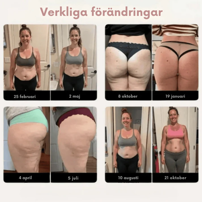 CirkuForm™ Leggings | Leggings som aktivt motverkar celluliter