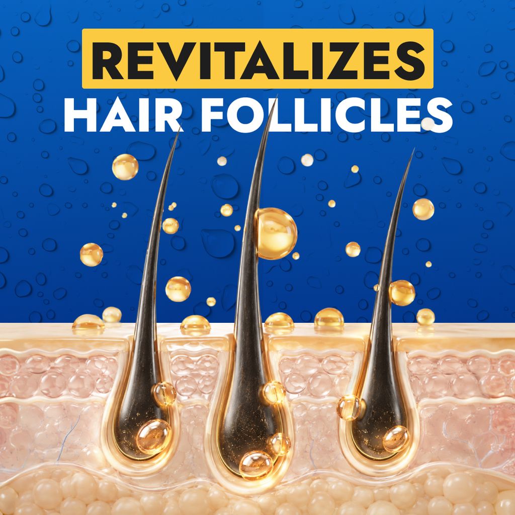 HårVäxt™ Minoxidil lotion 5 %