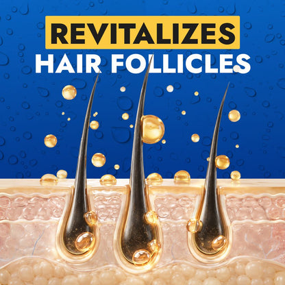 HårVäxt™ Minoxidil lotion 5 %
